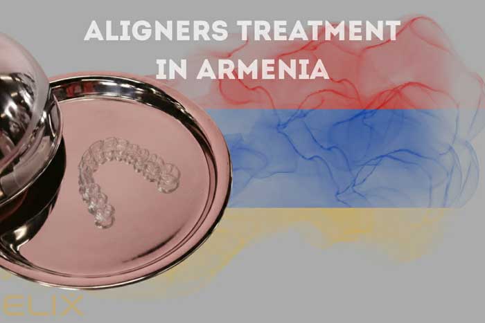 Էլայներներով բուժումը Հայաստանում